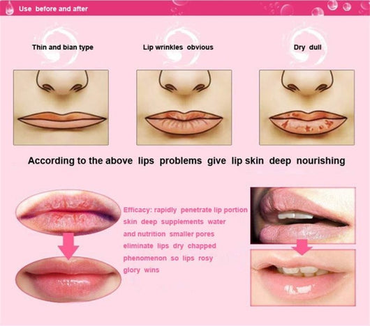 Pucker-up PINK Collagen Hydrating Lip Mask - 5 pack - HYVE Beauty